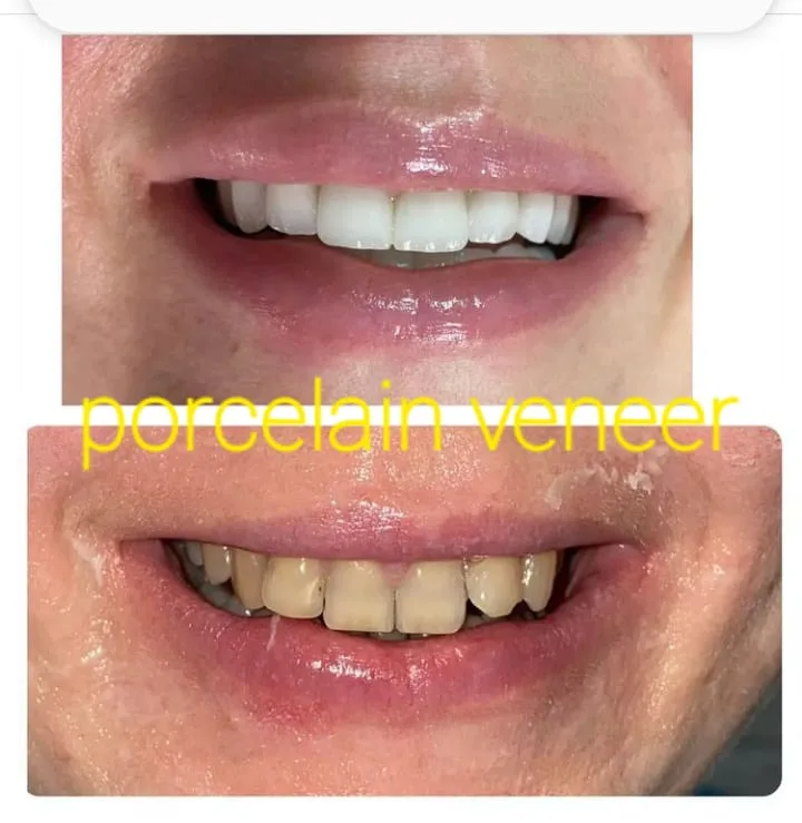 Alanya HEALTHY TEETH Dental Aesthetic — Léky v Alanyi: Online objednávka, ceny a recenze